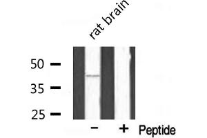 Western Blotting (WB) image for anti-Dual Specificity Phosphatase 9 (DUSP9) (Internal Region) antibody (ABIN6257141)