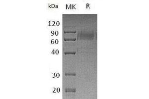 Western Blotting (WB) image for TYRO3 Protein Tyrosine Kinase (TYRO3) protein (mFc Tag) (ABIN7320680)