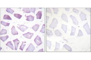 Immunohistochemistry analysis of paraffin-embedded human skeletal muscle, using PEA-15 (Phospho-Ser116) Antibody.