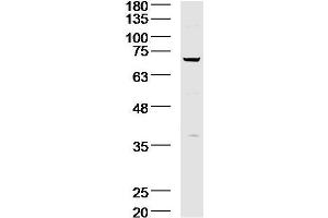 Lane 1: A431 lysates probed with Acid sphingomyelinase Antibody  at 1:300 overnight at 4˚C. (SMPD1 Antikörper  (AA 201-300))