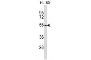 MGAT3 Antibody (C-term) western blot analysis in HL-60 cell line lysates (35µg/lane). (MGAT3 Antikörper  (C-Term))