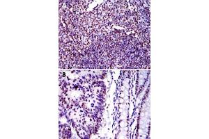 Immunohistochemical analysis of paraffin-embedded human tonsil tissue (A) and human colon cancer tissue (B) using XRCC5 monoclonal antobody, clone 5C5  with DAB staining.