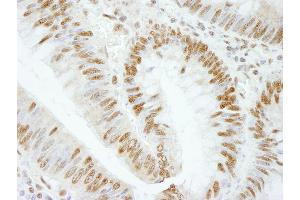 Immunohistochemistry (IHC) image for anti-RNA Binding Motif Protein 25 (RBM25) (AA 475-525) antibody (ABIN7448762) (RBM25 Antikörper  (AA 475-525))
