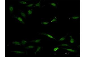 Immunofluorescence of purified MaxPab antibody to NFAT5 on HeLa cell. (NFAT5 Antikörper  (AA 1-1484))
