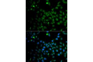 Immunofluorescence analysis of A549 cells using SMAD9 antibody. (SMAD9 Antikörper)