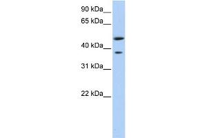 WB Suggested Anti-MAGEA3 Antibody Titration:  0. (MAGEA3 Antikörper  (Middle Region))