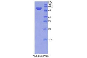 SDS-PAGE (SDS) image for Histidine-Rich Glycoprotein (HRG) (AA 93-328) protein (His tag,GST tag) (ABIN1877405)