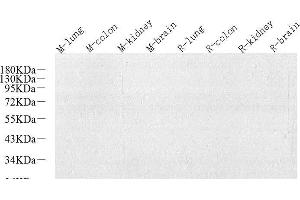 Western Blot analysis of various samples using N/H/K-Ras Polyclonal Antibody at dilution of 1:800. (N/H/K-Ras Antikörper)