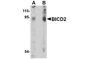 Image no. 1 for anti-Bicaudal D Homolog 2 (BICD2) (C-Term) antibody (ABIN342679) (BICD2 Antikörper  (C-Term))