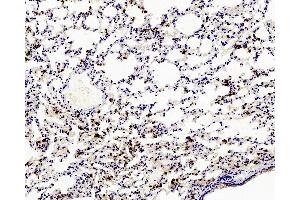 Immunohistochemistry analysis of paraffin-embedded mouse Inflammatory lung using Ly6g Polyclonal Antibody at dilution of 1:200. (Ly6g Antikörper)
