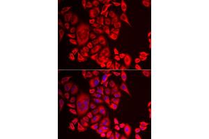 Immunofluorescence analysis of MCF-7 cells using QPCT antibody (ABIN5974054). (QPCT Antikörper)