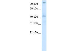 WB Suggested Anti-POGZ Antibody Titration:  5. (POGZ Antikörper  (N-Term))
