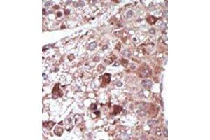 Image no. 2 for anti-phosphoenolpyruvate Carboxykinase 1 (Soluble) (PCK1) (N-Term) antibody (ABIN360565) (PCK1 Antikörper  (N-Term))