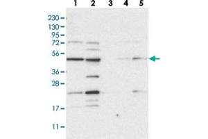 Western blot analysis of Lane 1: RT-4, Lane 2: U-251 MG, Lane 3: Human Plasma, Lane 4: Liver, Lane 5: Tonsil with NAPEPLD polyclonal antibody  at 1:250-1:500 dilution.