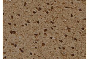 ABIN6276475 at 1/100 staining Rat brain tissue by IHC-P. (PSMD4/ASF Antikörper  (Internal Region))