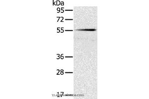 Western blot analysis of Mouse pancreas tissue, using SLC16A10 Polyclonal Antibody at dilution of 1:200 (SLC16A10 Antikörper)