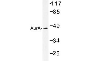 Image no. 1 for anti-Aurora Kinase A (AURKA) antibody (ABIN272125) (Aurora A Antikörper)