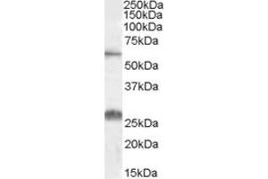 Western Blotting (WB) image for anti-Solute Carrier Family 47, Member 1 (SLC47A1) (AA 528-541) antibody (ABIN490521) (SLC47A1 Antikörper  (AA 528-541))