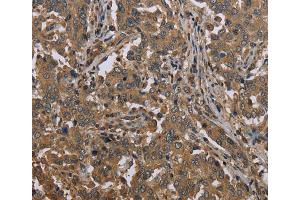 Immunohistochemistry (IHC) image for anti-Mutated in Colorectal Cancers (MCC) antibody (ABIN2433359)