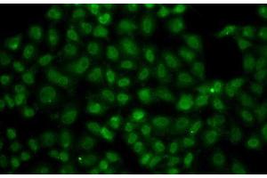 Immunofluorescence analysis of A549 cells using USP26 Polyclonal Antibody
