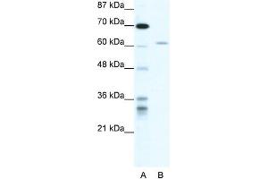 Human HepG2; WB Suggested Anti-ZNFN1A4 Antibody Titration: 1.