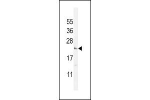 UTS2 Antibody (N-term) (ABIN392523 and ABIN2842080) western blot analysis in WiDr cell line lysates (35 μg/lane). (Urotensin 2 Antikörper  (N-Term))