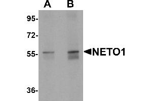 Western blot analysis of NETO1 in human lung tissue lysate with NETO1 antibody at (A) 1 and (B) 2 µg/mL. (NETO1 Antikörper  (C-Term))