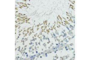 Immunohistochemistry of paraffin-embedded rat testis using TRIP12 antibody (ABIN6129753, ABIN6149543, ABIN6149544 and ABIN6225295) at dilution of 1:100 (40x lens). (TRIP12 Antikörper  (AA 1-240))