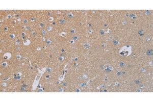Immunohistochemistry of paraffin-embedded Human brain tissue using HSD3B7 Polyclonal Antibody at dilution 1:40 (HSD3B7 Antikörper)