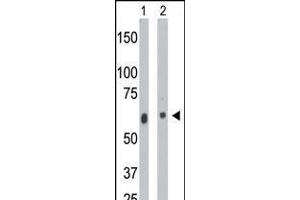 Antibody is used in Western blot to detect CERK in mouse heart tissue lysate (Lane 1) and A2058 cell lysate (Lane 2). (CERK Antikörper  (C-Term))
