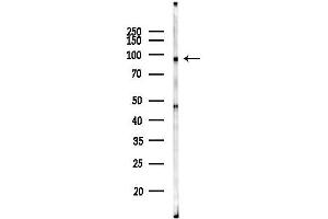 Western blot analysis of lysates from Mouse testis, using TRPV4 Antibody at 1/1000 dilution.