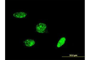 Immunofluorescence of monoclonal antibody to PAX8 on HeLa cell. (PAX8 Antikörper  (AA 1-450))
