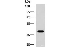 Western blot analysis of HepG2 cell lysate using PLPPR5 Polyclonal Antibody at dilution of 1:1500 (LPPR5 Antikörper)