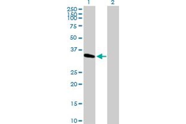 METTL2B Antikörper  (AA 1-313)