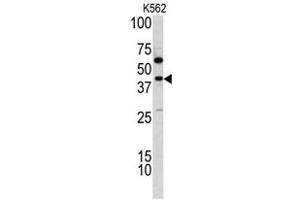 Western blot analysis of TDG antibody (C-term) in K562 cell line lysates (35ug/lane). (TDG Antikörper  (C-Term))