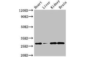 Western Blot Positive WB detected in: Mouse heart tissue, Mouse liver tissue, Mouse kidney tissue, Mouse brain tissue All lanes: GUCD1 antibody at 4 μg/mL Secondary Goat polyclonal to rabbit IgG at 1/50000 dilution Predicted band size: 28, 34 kDa Observed band size: 28 kDa (C22orf13 Antikörper  (AA 1-136))