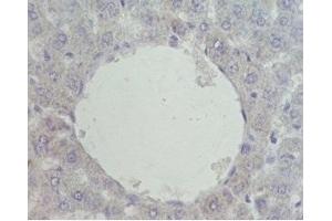 Immunohistochemistry (IHC) image for anti-Nuclear Receptor Subfamily 1, Group H, Member 4 (NR1H4) (AA 446-476) antibody (ABIN2872215)