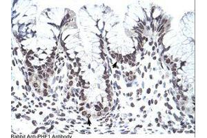 Image no. 1 for anti-PHD Finger Protein 1 (PHF1) (AA 421-470) antibody (ABIN202770) (PHF1 Antikörper  (AA 421-470))
