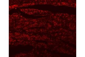 IF analysis of SF3A1 using anti-SF3A1 antibody (ABIN7600556). (SF3A1 Antikörper  (AA 20-556))