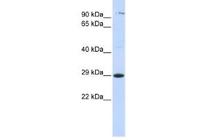 WB Suggested Anti-TSPAN2 Antibody Titration:  0.
