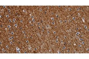 Immunohistochemistry of paraffin-embedded Human brain tissue using DCAF6 Polyclonal Antibody at dilution 1:30 (DCAF6 Antikörper)