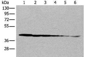 Western blot analysis of Rat brain tissue Human cerebrum tissue Human fetal brain tissue Hela cell Human breast cancer tissue Jurkat cell lysates using PITPNB Polyclonal Antibody at dilution of 1:500