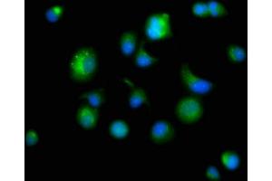 Immunofluorescence staining of MCF-7 cells with ABIN7164840 at 1:166, counter-stained with DAPI. (Prosaposin Antikörper  (AA 311-391))