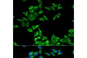 Immunofluorescence analysis of MCF-7 cells using CHMP2B Polyclonal Antibody (CHMP2B Antikörper)