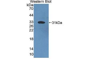Western blot analysis of the recombinant protein. (Complement C4 Antikörper  (AA 126-366))
