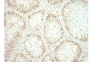 Immunohistochemistry (IHC) image for anti-RuvB-Like 2 (E. Coli) (RUVBL2) (AA 1-50) antibody (ABIN7448783)