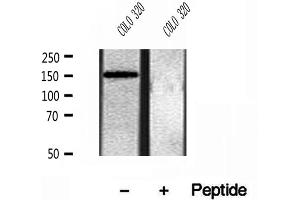 Western blot analysis of extracts of COLO 320 cells, using KIAA1199 antibody. (CEMIP Antikörper  (C-Term))