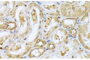 Immunohistochemistry of paraffin-embedded Rat kidney using RPS27A Polyclonal Antibody at dilution of 1:100 (40x lens). (RPS27A Antikörper)