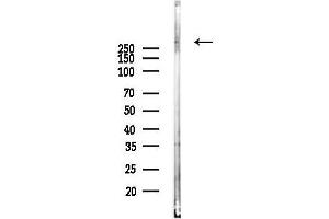 anti-Centrosomal Protein 250kDa (CEP250) (C-Term) antibody