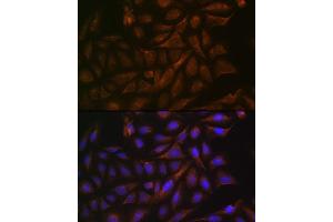 Immunofluorescence analysis of U-2 OS cells using V/V/Cellubrevin Rabbit mAb (ABIN7271314) at dilution of 1:100 (40x lens). (VAMP3 Antikörper)